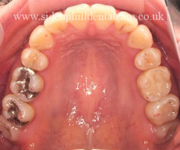 Case Study 3 After Treatment