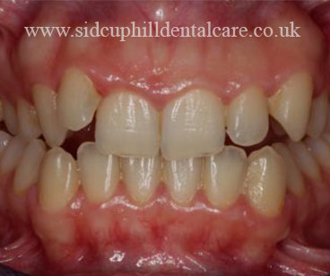 Case Study 1 Before Treatment